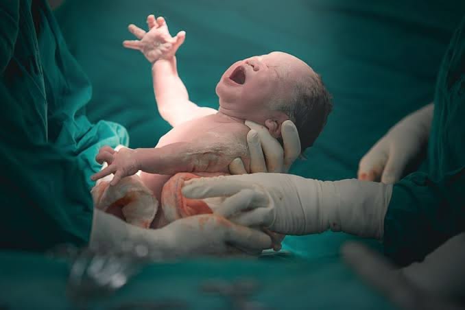 Bidan merawat bayi baru lahir